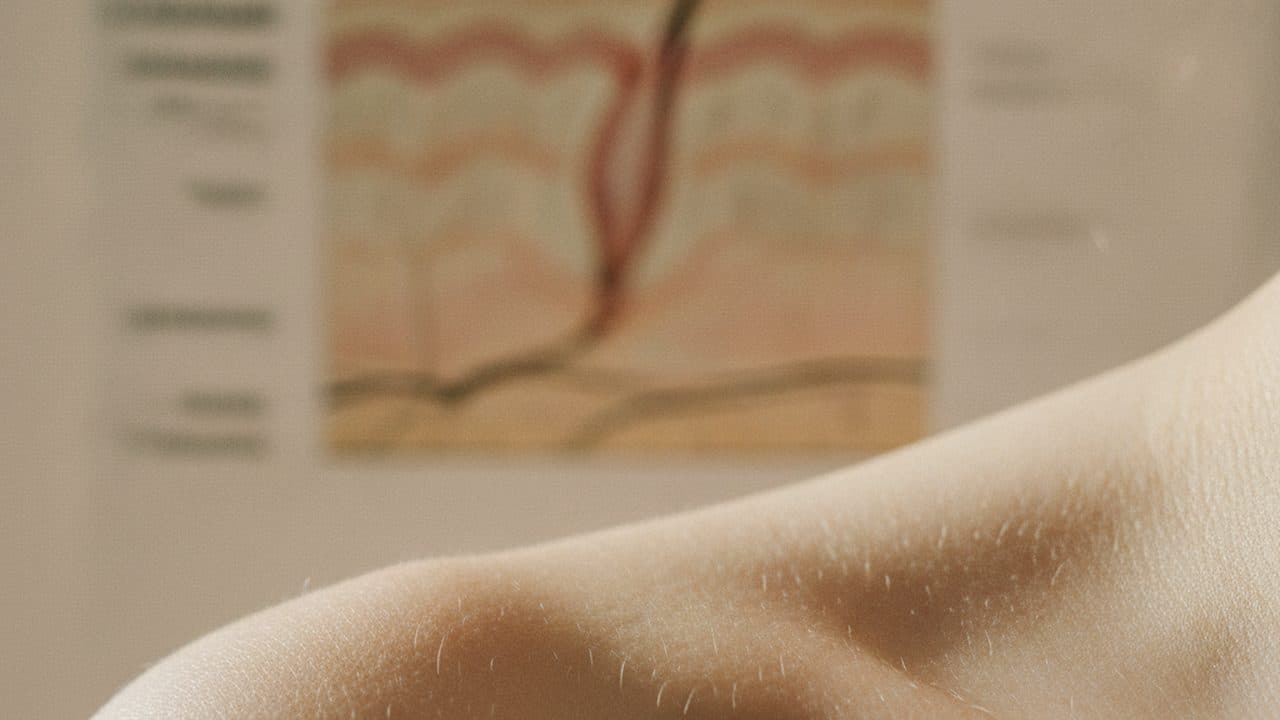 Anatomie de la Peau